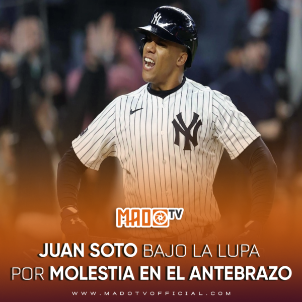 Juan Soto bajo la lupa por molestia en el antebrazo